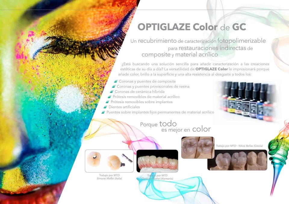 La versatilidad de OPTIGLAZE Color le impresionará porque añade color, brillo a la superficie y una alta resistencia al desgaste a todos los: Coronas y puentes de composite Coronas y puentes