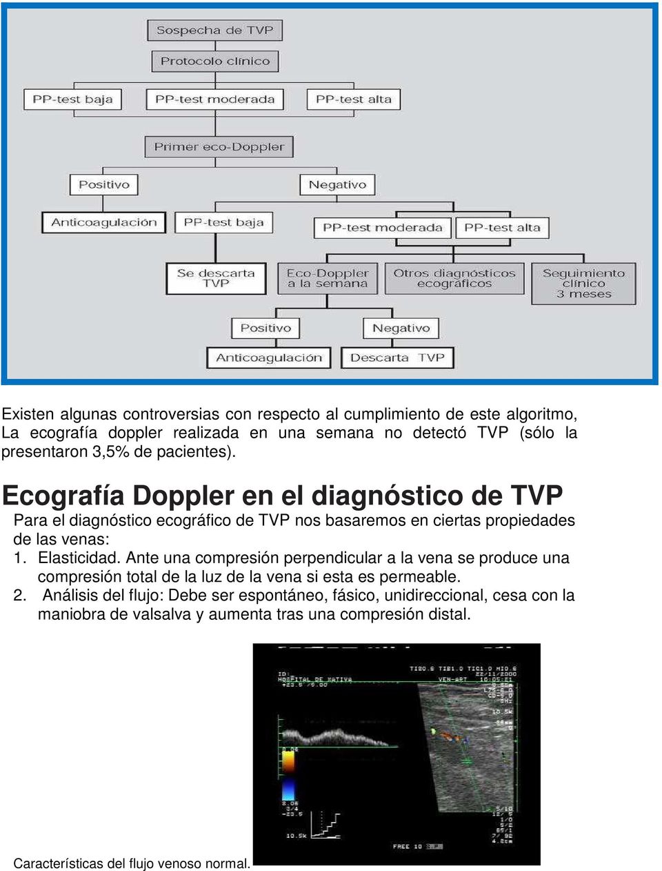 Ecografía Doppler en el diagnóstico de TVP Para el diagnóstico ecográfico de TVP nos basaremos en ciertas propiedades de las venas:. Elasticidad.