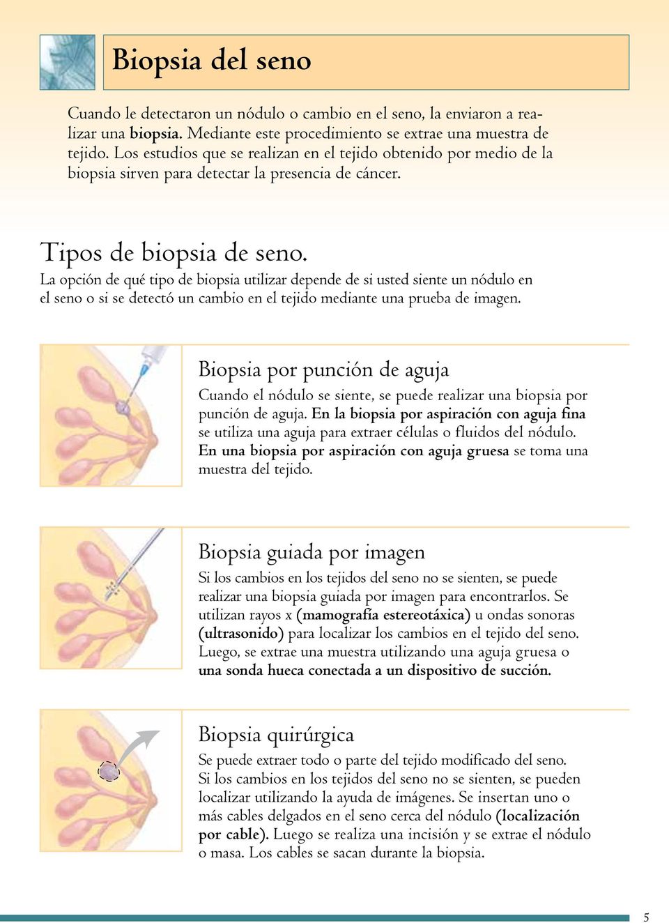 La opción de qué tipo de biopsia utilizar depende de si usted siente un nódulo en el seno o si se detectó un cambio en el tejido mediante una prueba de imagen.