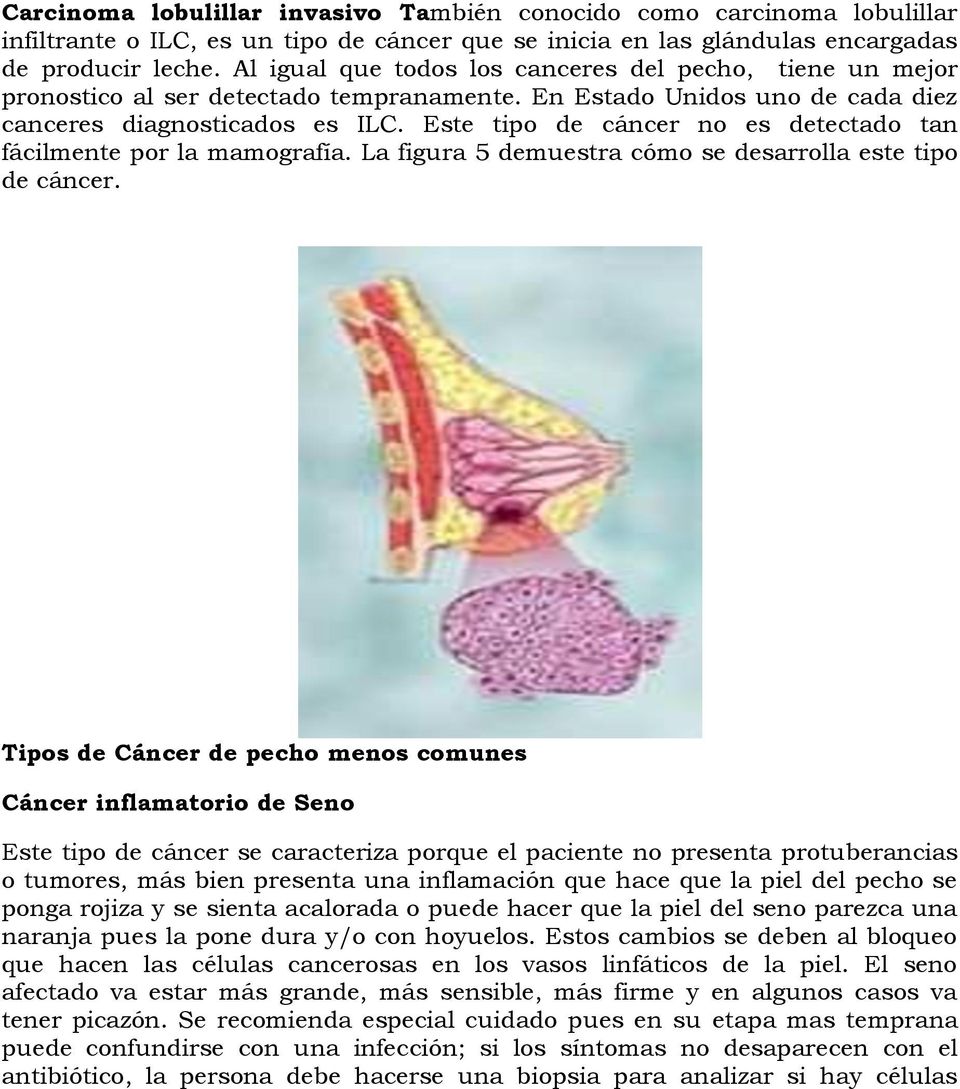 Este tipo de cáncer no es detectado tan fácilmente por la mamografía. La figura 5 demuestra cómo se desarrolla este tipo de cáncer.