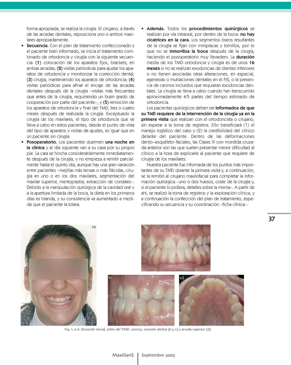 brackets, en ambas arcadas; (2) visitas periódicas para ajustar los aparatos de ortodoncia y monitorizar la corrección dental; (3) cirugía, manteniendo los aparatos de ortodoncia; (4) visitas