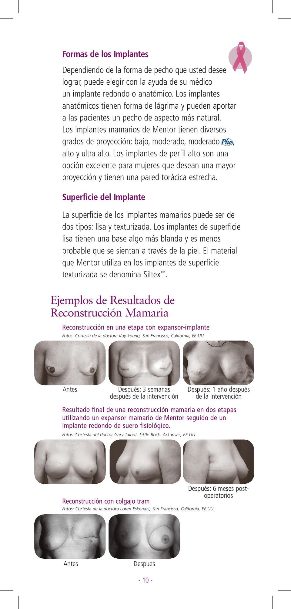 Los implantes mamarios de Mentor tienen diversos grados de proyección: bajo, moderado, moderado, alto y ultra alto.