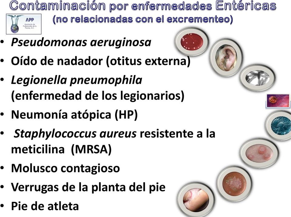 Neumonía atópica (HP) Staphylococcus aureus resistente a la