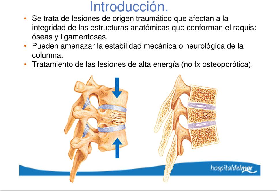 las estructuras anatómicas que conforman el raquis: óseas y ligamentosas.