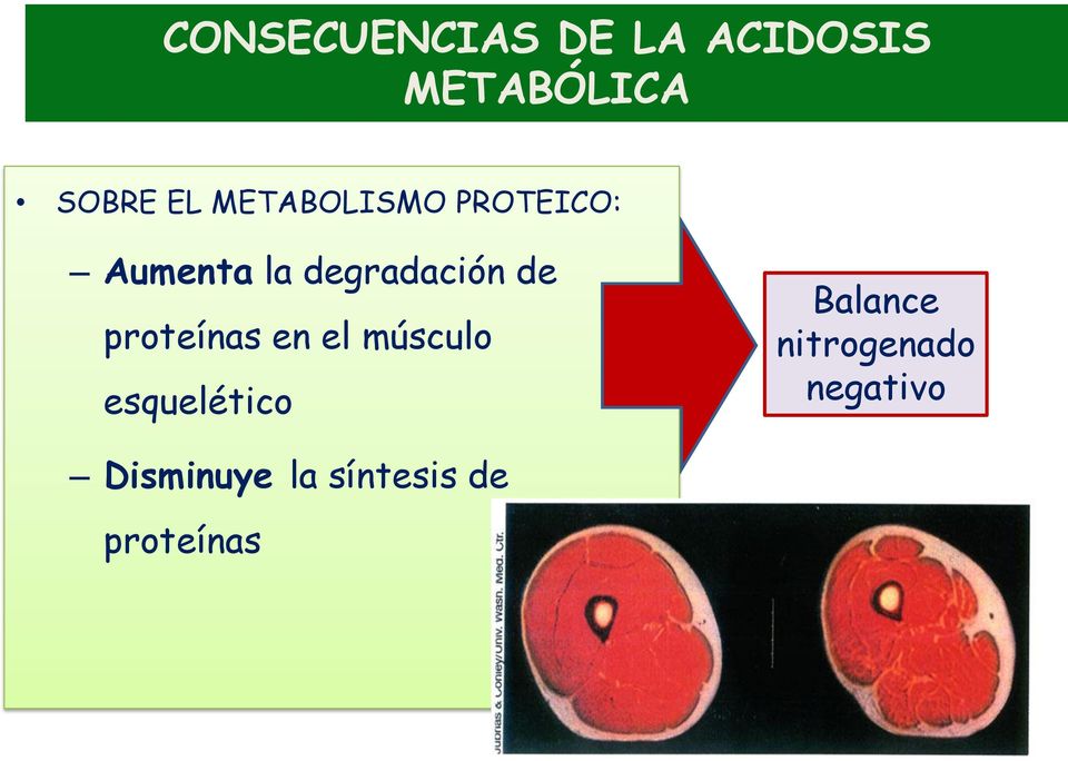 proteínas en el músculo esquelético Balance
