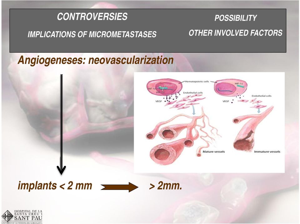 INVOLVED FACTORS Angiogeneses: