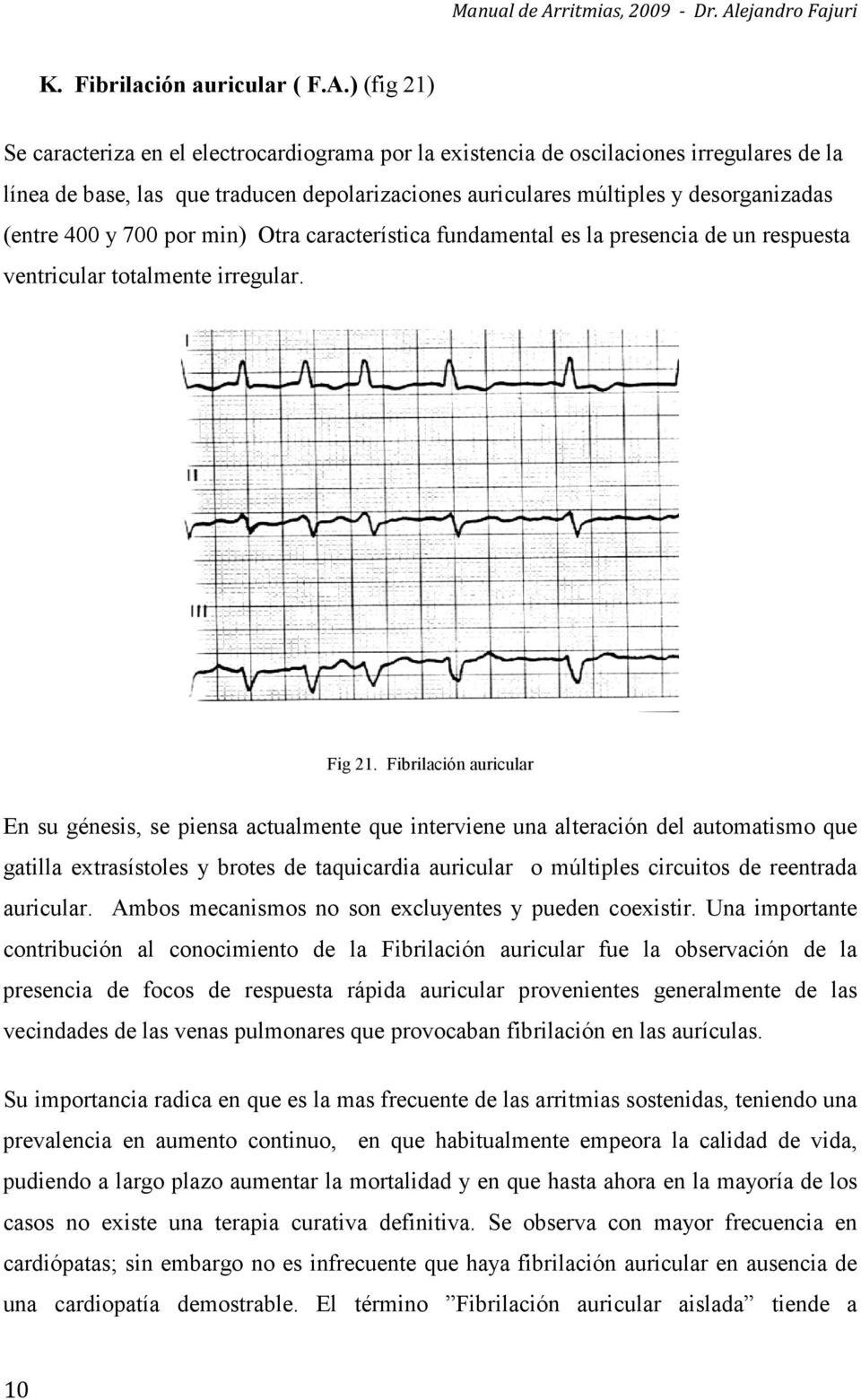 400 y 700 por min) Otra característica fundamental es la presencia de un respuesta ventricular totalmente irregular. Fig 21.