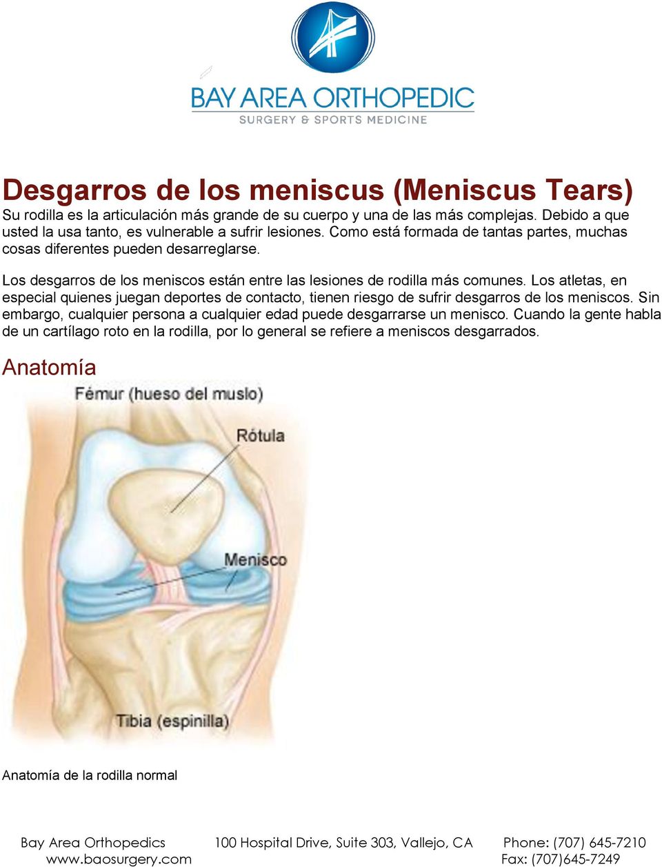 Los desgarros de los meniscos están entre las lesiones de rodilla más comunes.