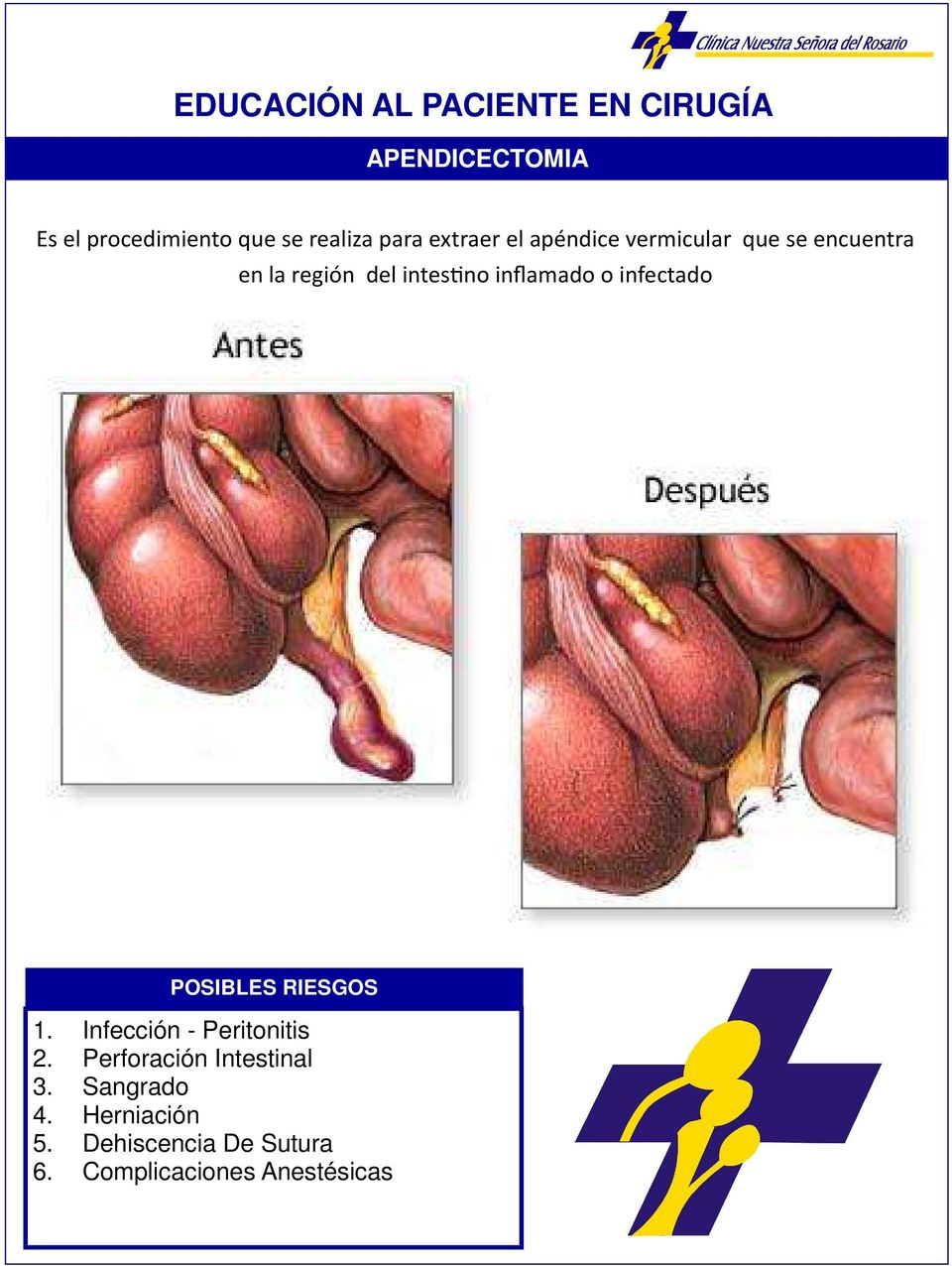 inflamado o infectado - Peritonitis 2. Perforación Intestinal 3.