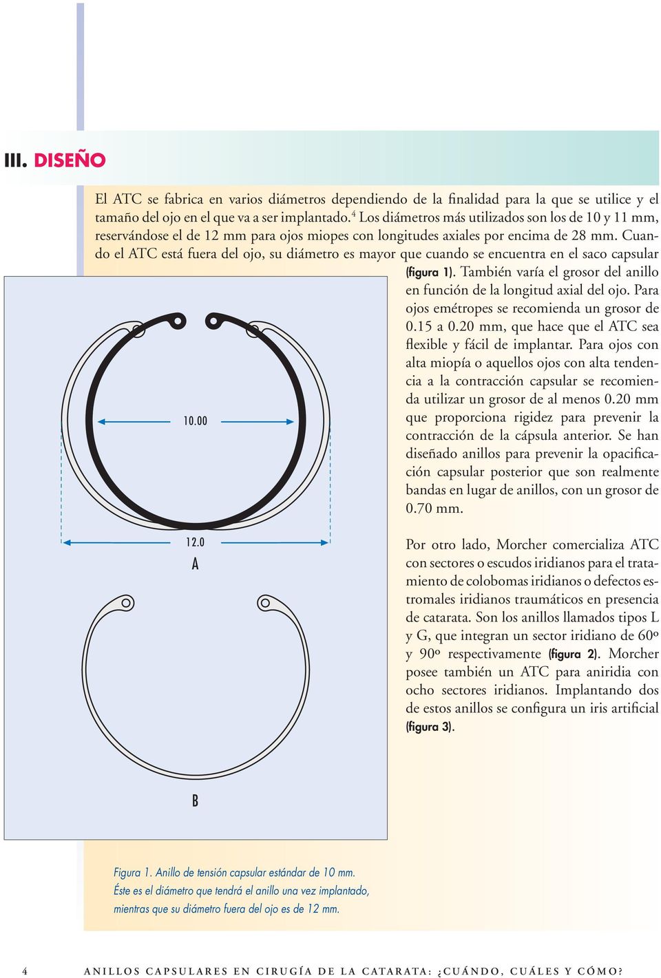 Cuando el ATC está fuera del ojo, su diámetro es mayor que cuando se encuentra en el saco capsular (figura 1). También varía el grosor del anillo en función de la longitud axial del ojo.