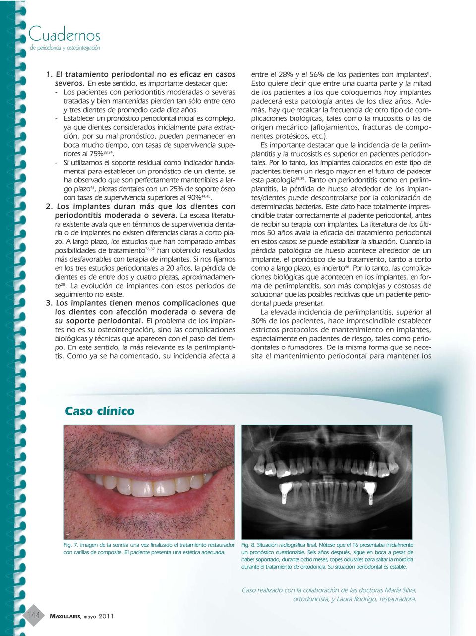 - Establecer un pronóstico periodontal inicial es complejo, ya que dientes considerados inicialmente para extracción, por su mal pronóstico, pueden permanecer en boca mucho tiempo, con tasas de