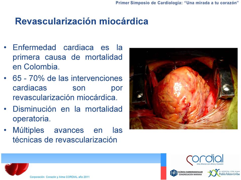 65-70% de las intervenciones cardiacas son por revascularización