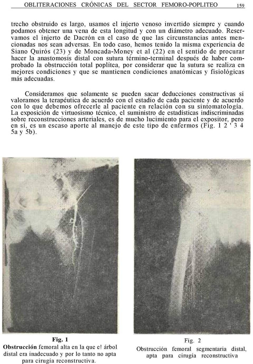 En todo caso, hemos tenido la misma experiencia de Siano Quirós (23) y de Moncada-Money et al (22) en el sentido de procurar hacer la anastomosis distal con sutura término-terminal después de haber