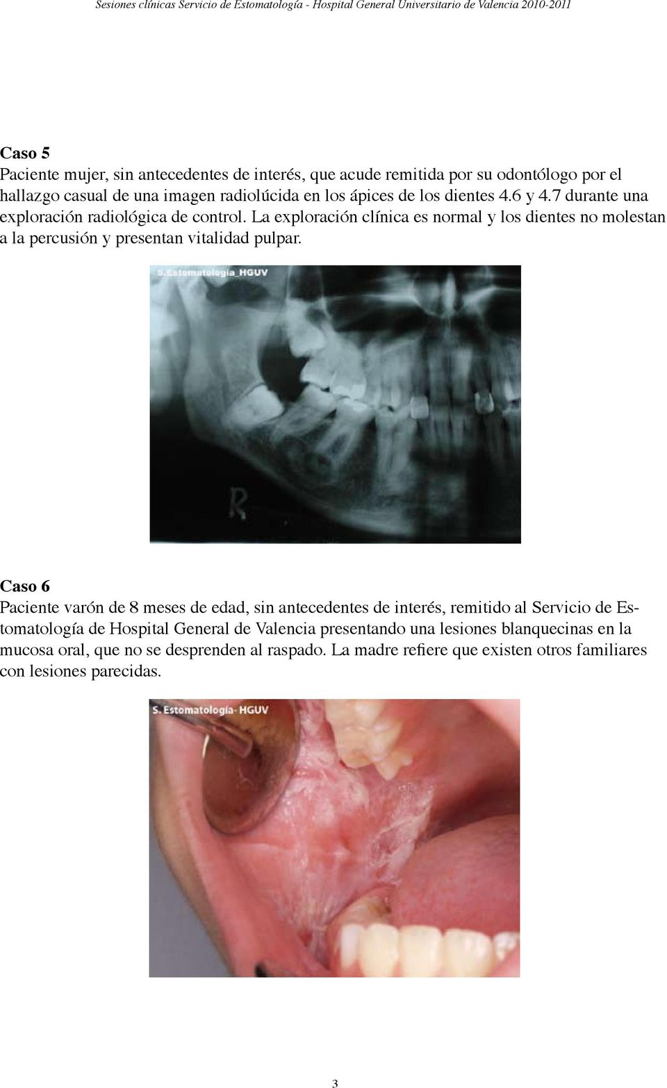 La exploración clínica es normal y los dientes no molestan a la percusión y presentan vitalidad pulpar.