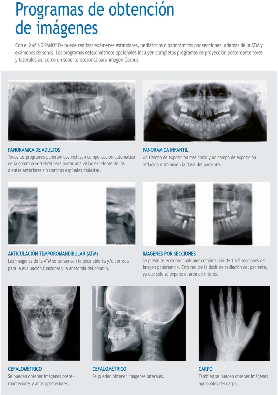 PANORÁMICA DE ADULTOS Todos los programas panorámicos incluyen compensación automática de la columna vertebral para lograr una visión excelente de los dientes anteriores sin sombras espinales