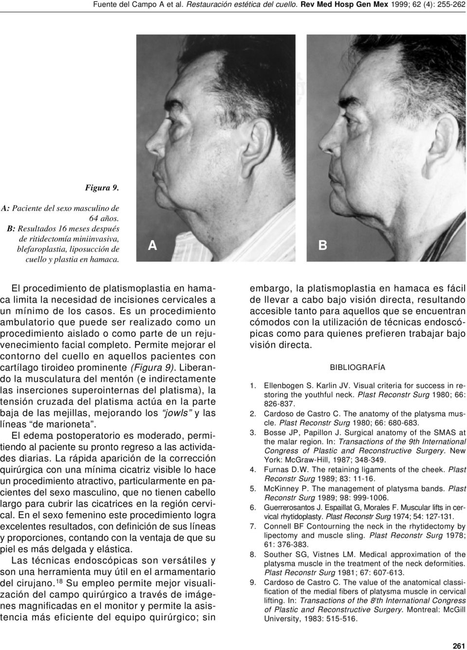 Es un procedimiento ambulatorio que puede ser realizado como un procedimiento aislado o como parte de un rejuvenecimiento facial completo.