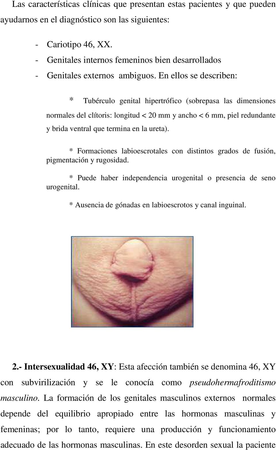 En ellos se describen: * Tubérculo genital hipertrófico (sobrepasa las dimensiones normales del clítoris: longitud < 20 mm y ancho < 6 mm, piel redundante y brida ventral que termina en la ureta).