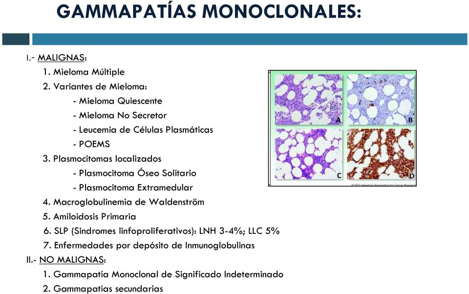 Plasmocitomas localizados - Plasmocitoma Óseo Solitario - Plasmocitoma Extramedular 4. Macroglobulinemia de Waldenström 5.