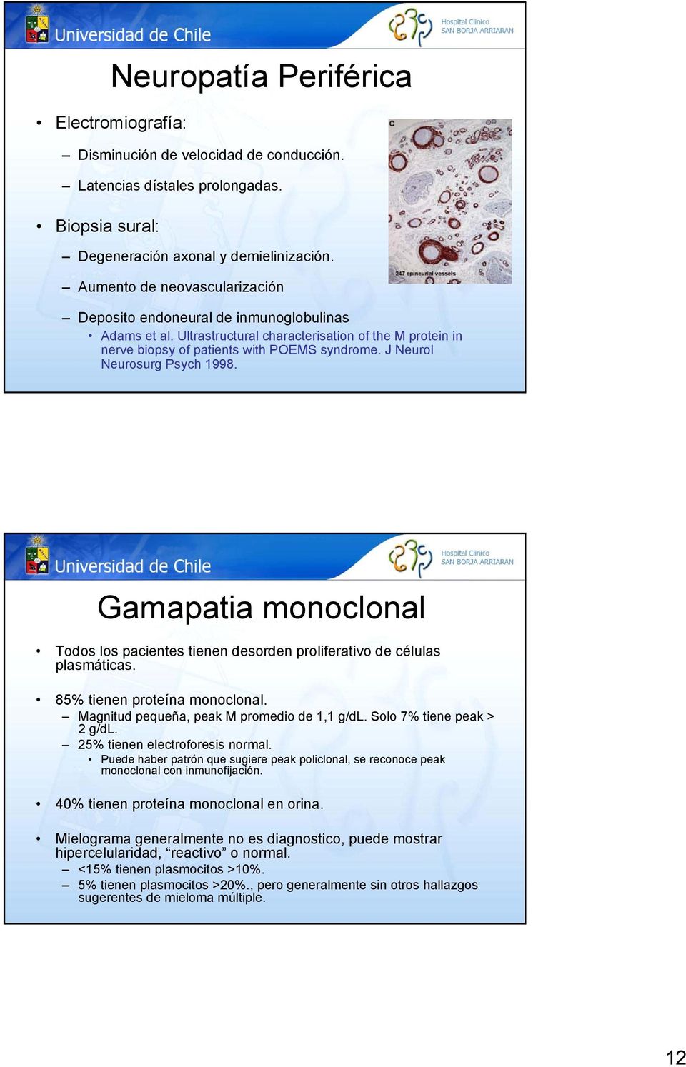 J Neurol Neurosurg Psych 1998. Gamapatia monoclonal Todos los pacientes tienen desorden proliferativo de células plasmáticas. 85% tienen proteína monoclonal.
