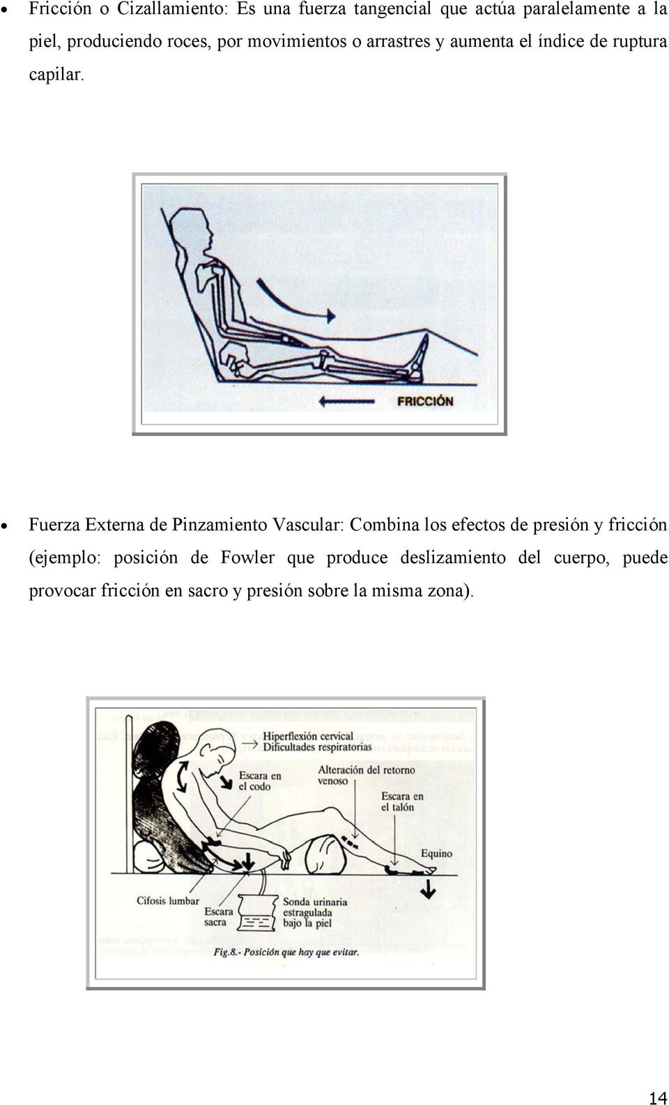 Fuerza Externa de Pinzamiento Vascular: Combina los efectos de presión y fricción (ejemplo: