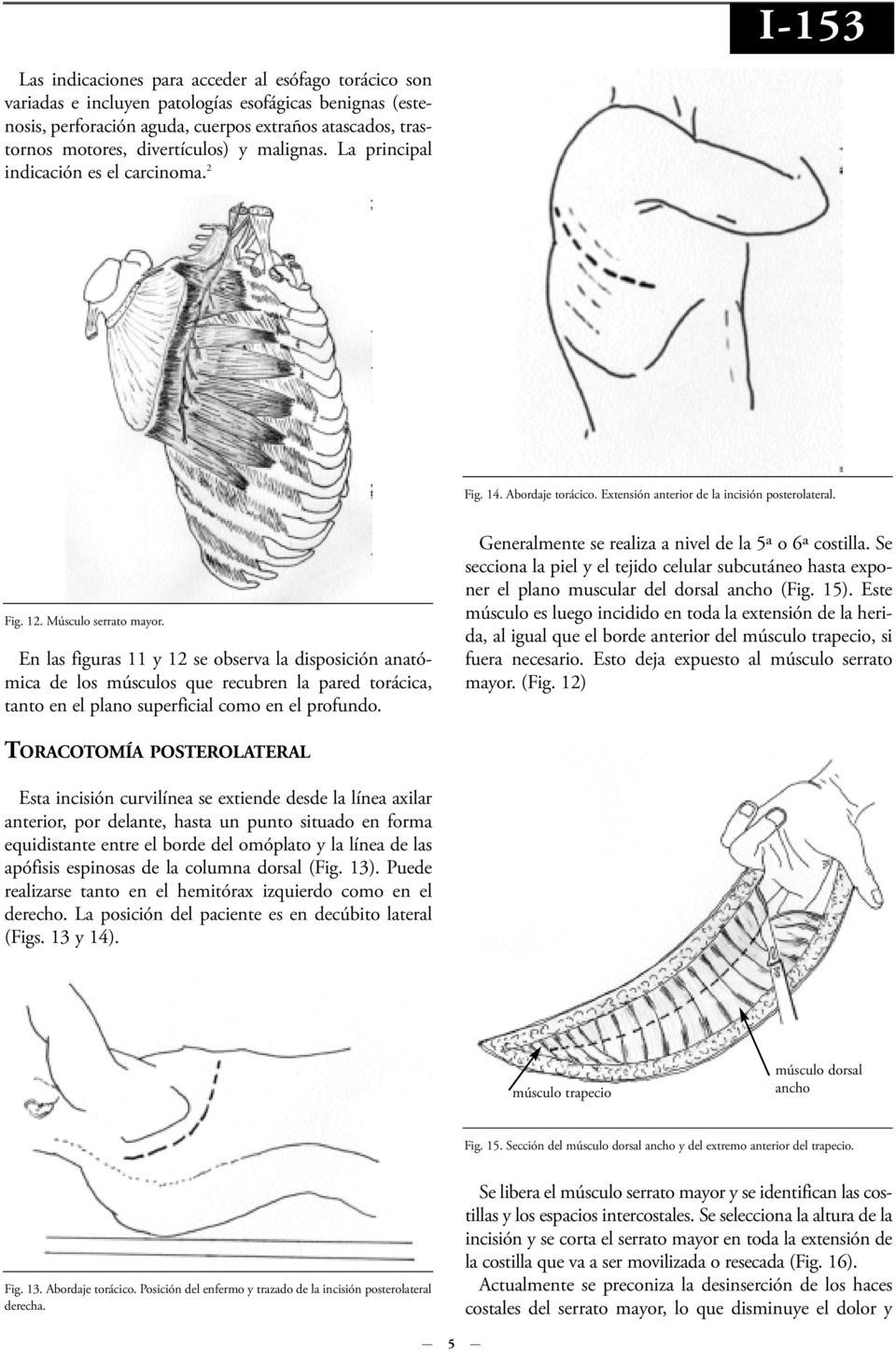 En las figuras 11 y 12 se observa la disposición anatómica de los músculos que recubren la pared torácica, tanto en el plano superficial como en el profundo.