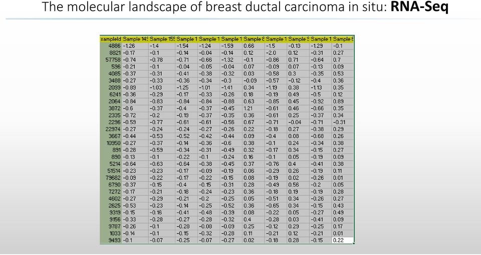 breast ductal