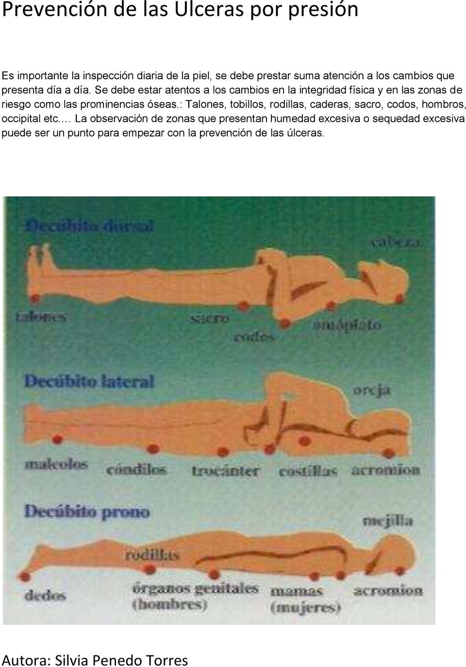 óseas.: Talones, tobillos, rodillas, caderas, sacro, codos, hombros, occipital etc.