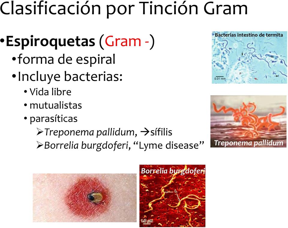 Treponema pallidum, sífilis Borrelia burgdoferi, Lyme disease