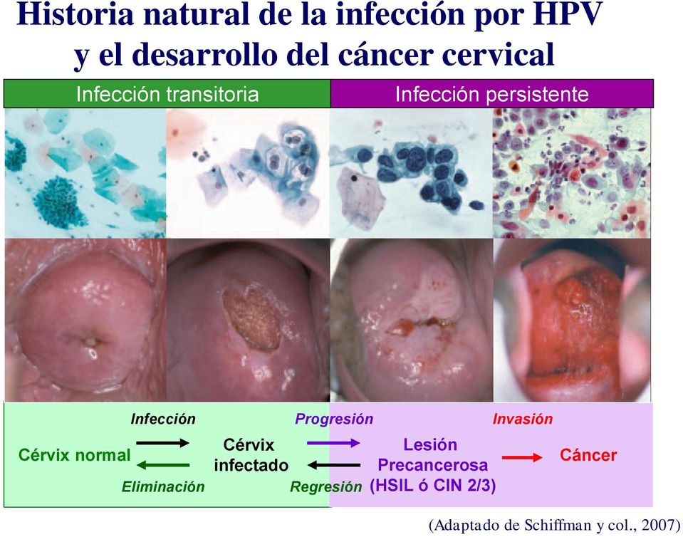 Infección Eliminación Progresión Cérvix infectado Regresión Lesión