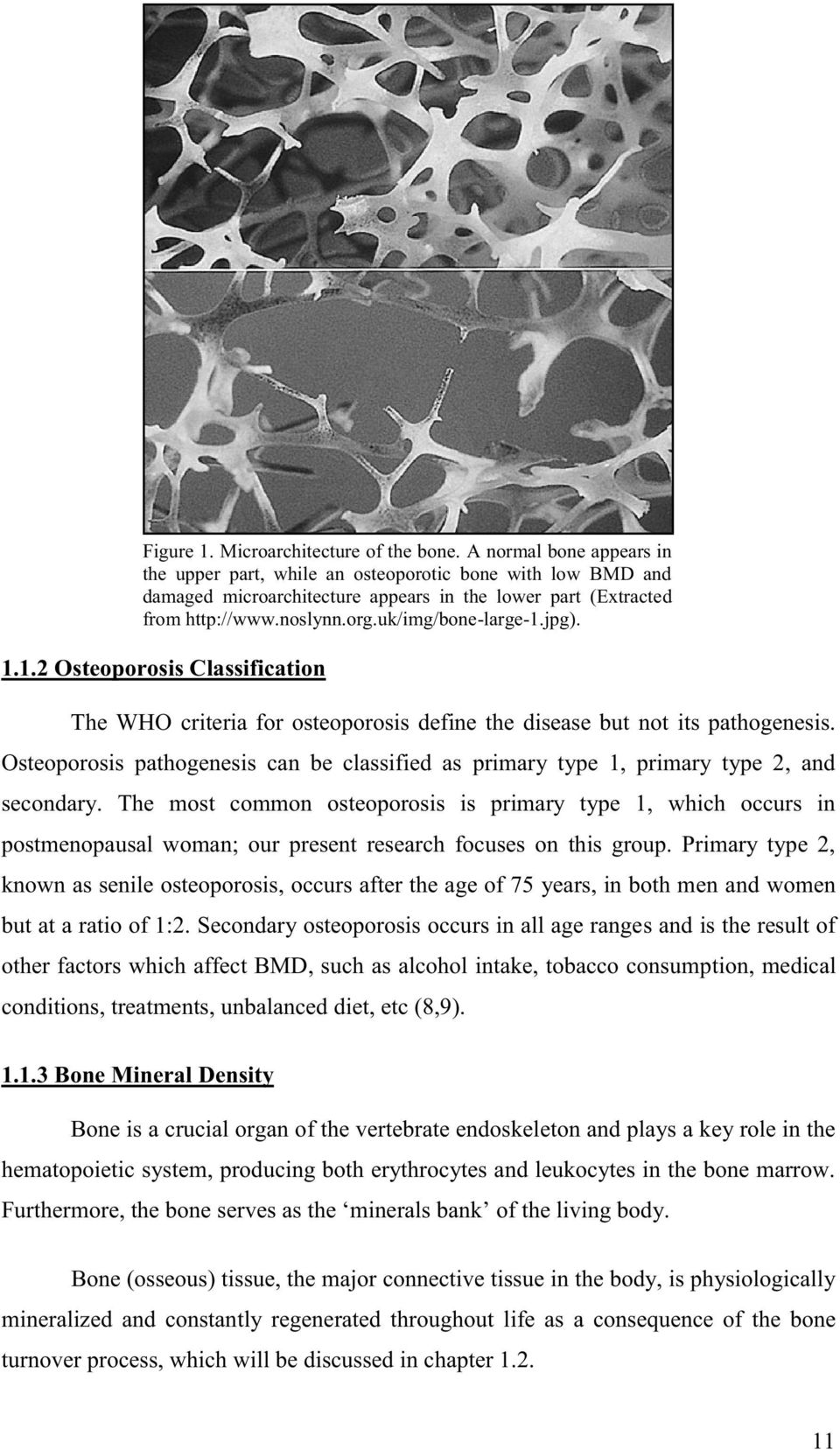jpg). 1.1.2 Osteoporosis Classification The WHO criteria for osteoporosis define the disease but not its pathogenesis.