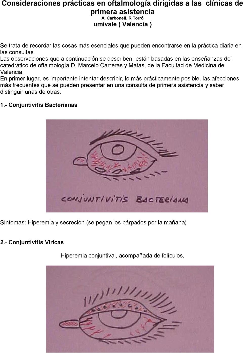 Las observaciones que a continuación se describen, están basadas en las enseñanzas del catedrático de oftalmología D. Marcelo Carreras y Matas, de la Facultad de Medicina de Valencia.