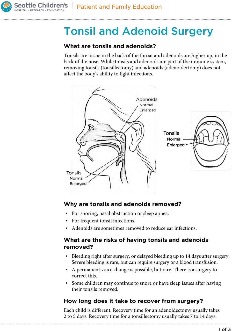 Why are tonsils and adenoids removed? For snoring, nasal obstruction or sleep apnea. For frequent tonsil infections. Adenoids are sometimes removed to reduce ear infections.