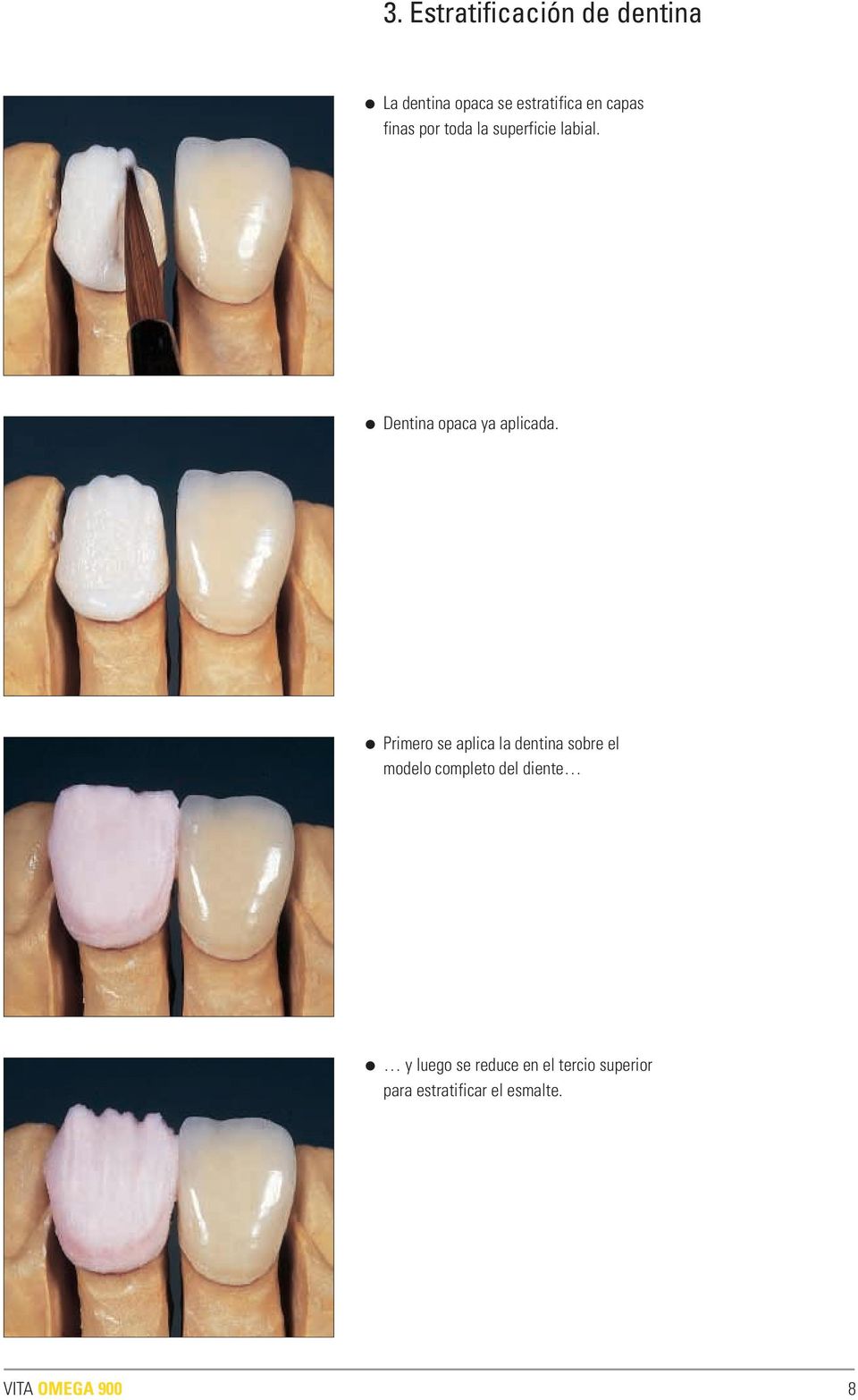 Primero se aplica la dentina sobre el modelo completo del diente y