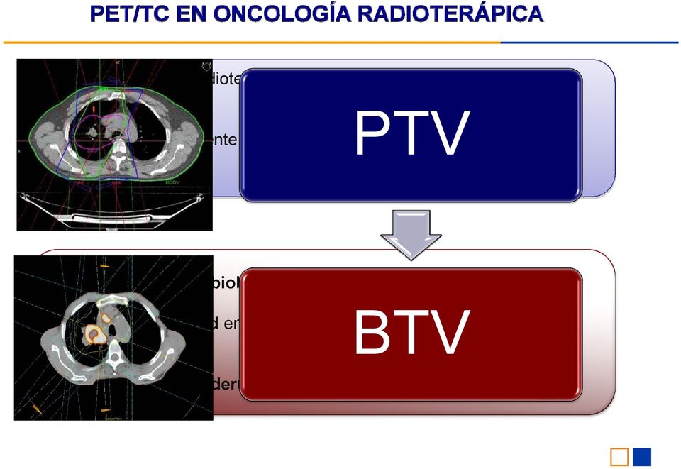 Imagen anatómica PTV Imagen funcional/biológica.