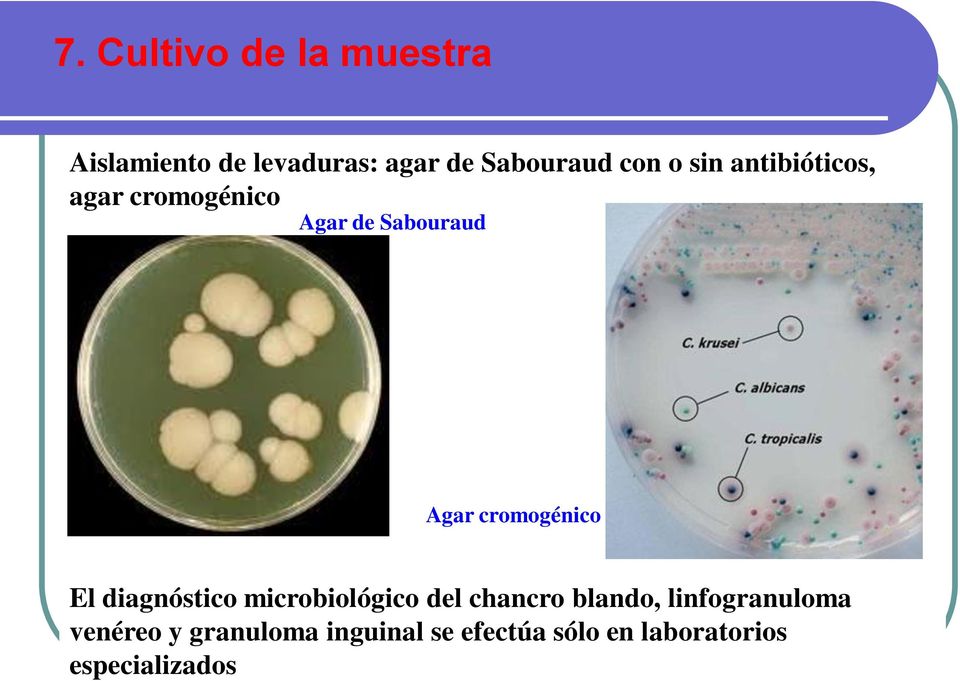 cromogénico El diagnóstico microbiológico del chancro blando,