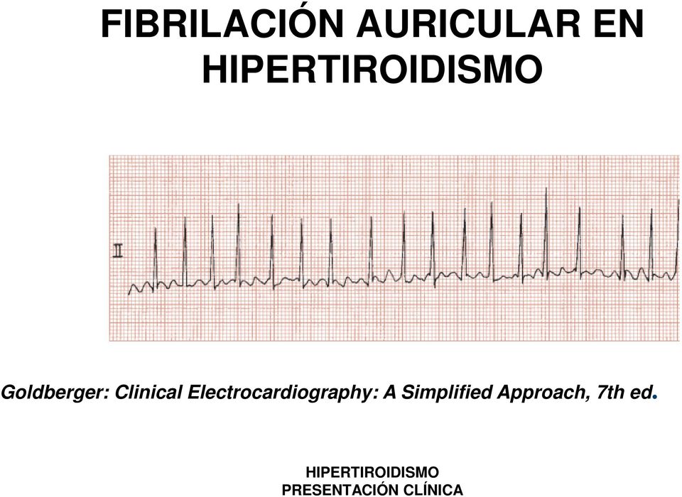 Electrocardiography: A Simplified