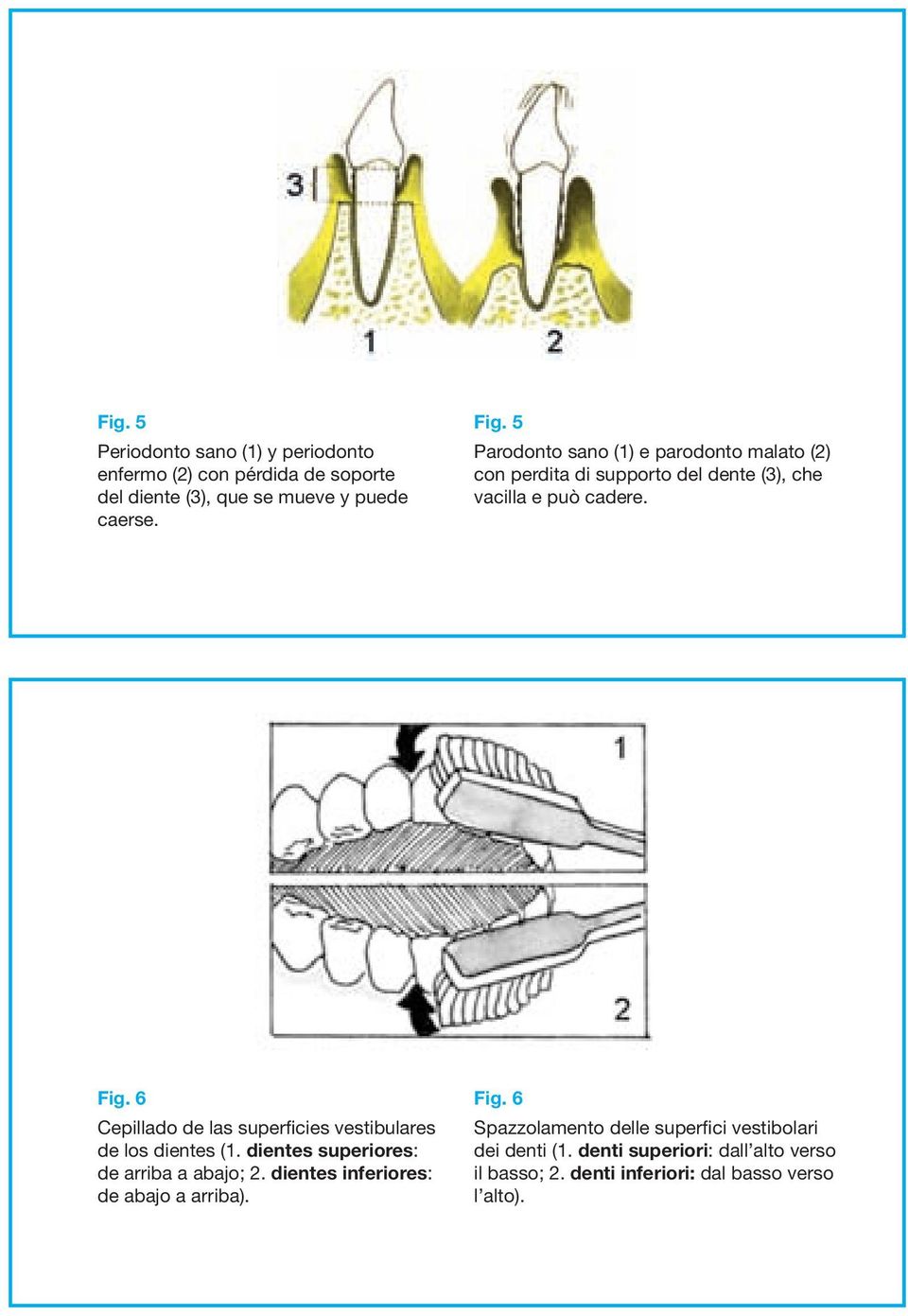6 - Spazzolamento delle superfici vestibolari dei denti (1. denti superiori: dall alto verso il basso; 2. denti inferiori: dal basso verso l alto). Fig.