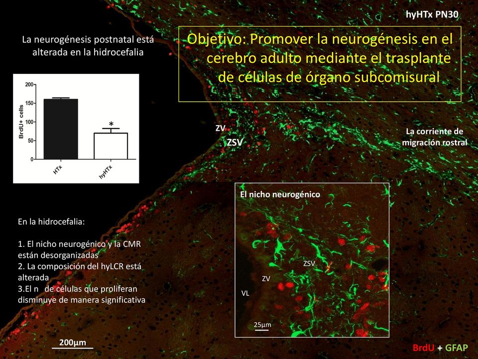 El nicho neurogénico En la hidrocefalia: 1. El nicho neurogénico y la CMR están desorganizadas 2.