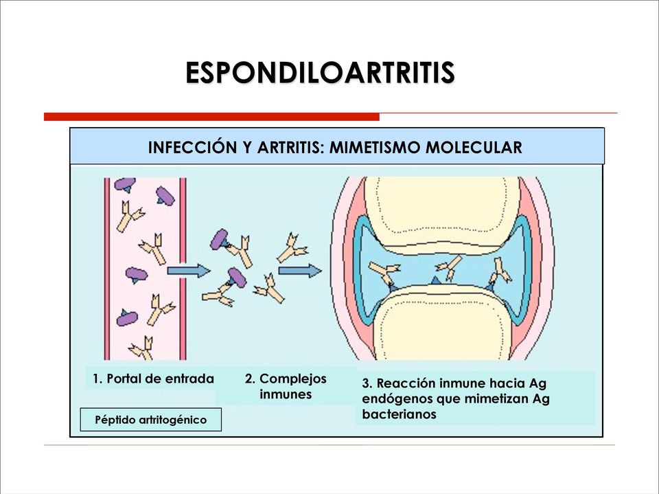Complejos inmunes Péptido artritogénico 3.