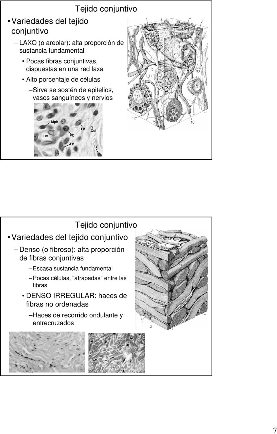 Tejido conjuntivo Variedades del tejido conjuntivo Denso (o fibroso): alta proporción de fibras conjuntivas Escasa sustancia