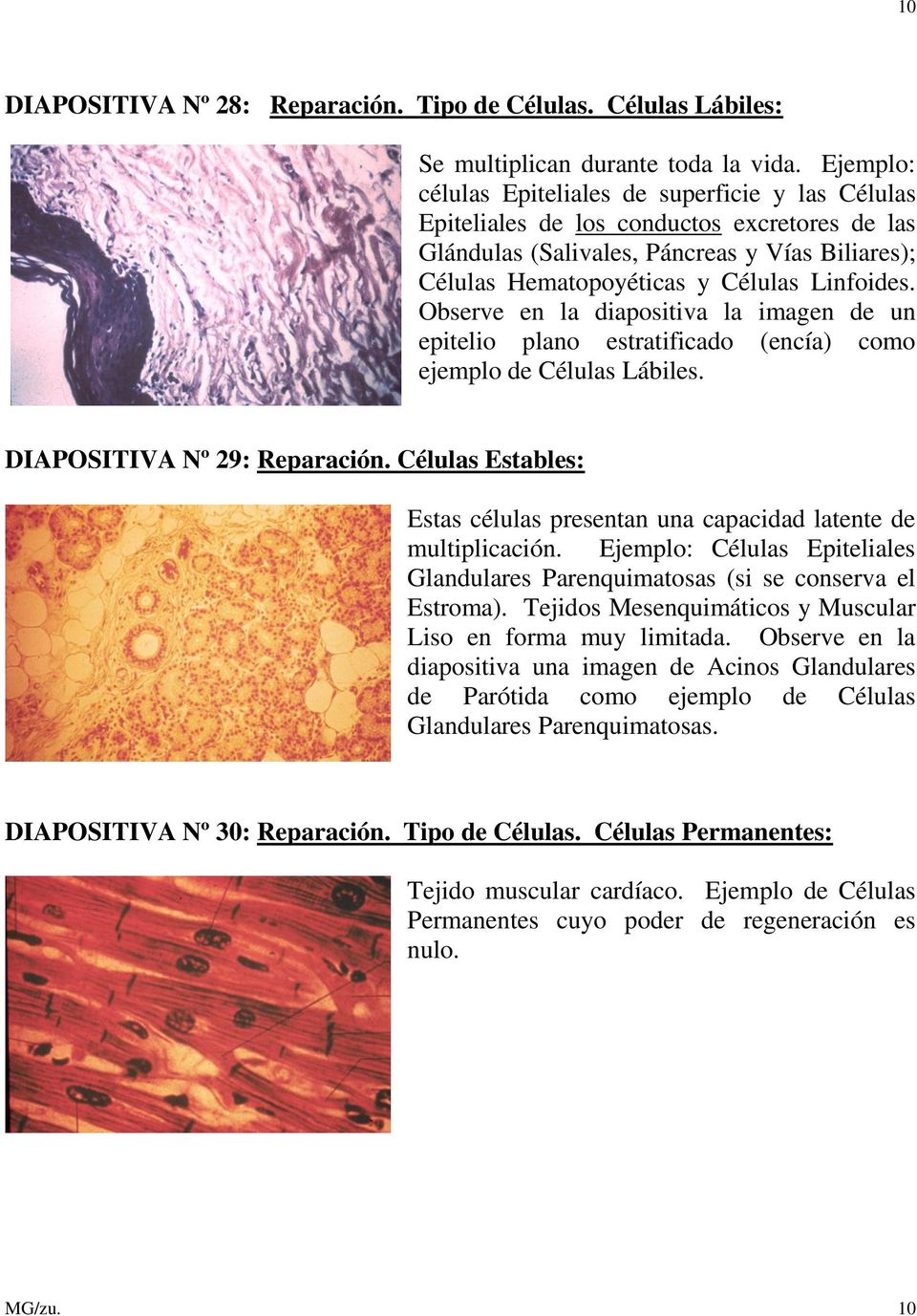 Observe en la diapositiva la imagen de un epitelio plano estratificado (encía) como ejemplo de Células Lábiles. DIAPOSITIVA Nº 29: Reparación.
