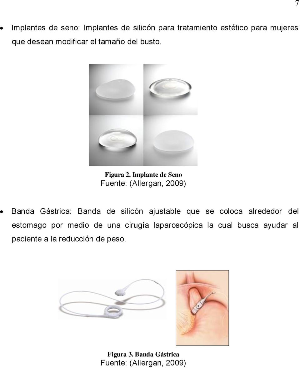 Implante de Seno Fuente: (Allergan, 2009) Banda Gástrica: Banda de silicón ajustable que se coloca