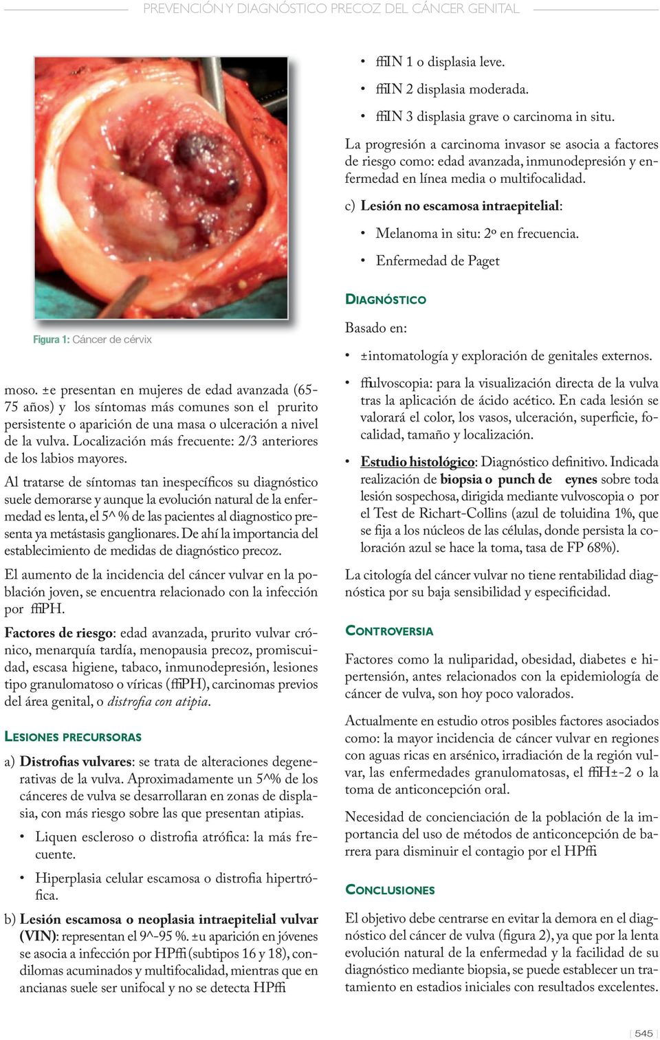 c) Lesión no escamosa intraepitelial: Melanoma in situ: 2º en frecuencia. Enfermedad de Paget DIAGNÓSTICO Figura 1: Cáncer de cérvix moso.