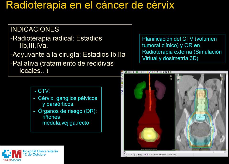 ..) Planificación del CTV (volumen tumoral clínico) y OR en Radioterapia externa (Simulación Virtual