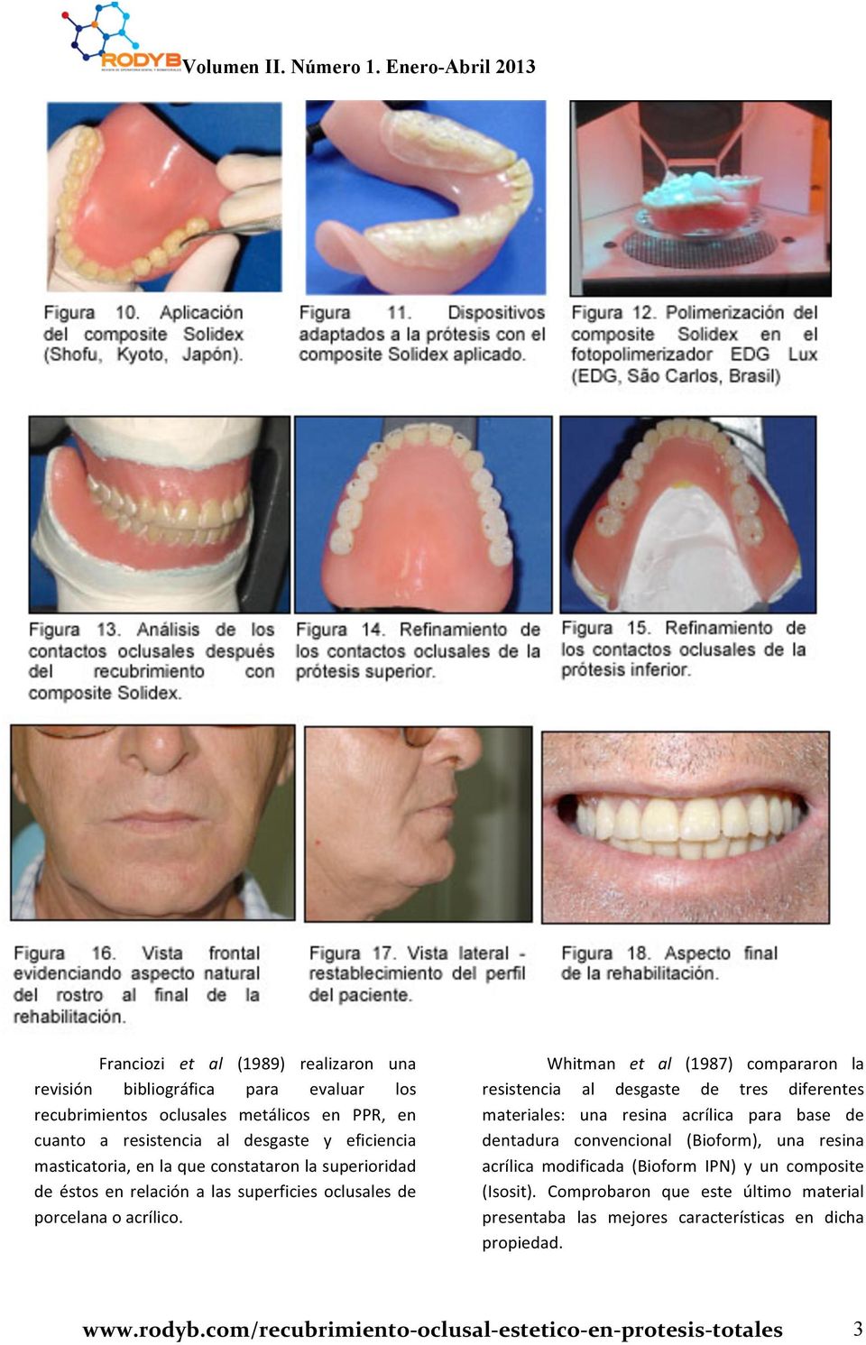 Whitman et al (1987) compararon la resistencia al desgaste de tres diferentes materiales: una resina acrílica para base de dentadura convencional