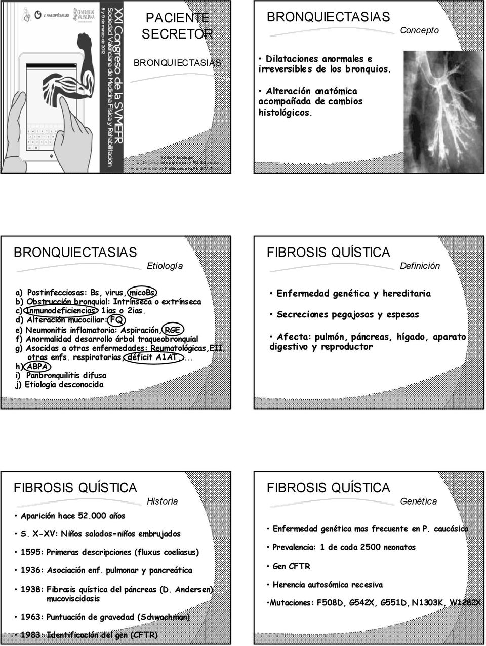 b) Obstrucción bronquial: Intrínseca o extrínseca c) Inmunodeficiencias: 1ias o 2ias.