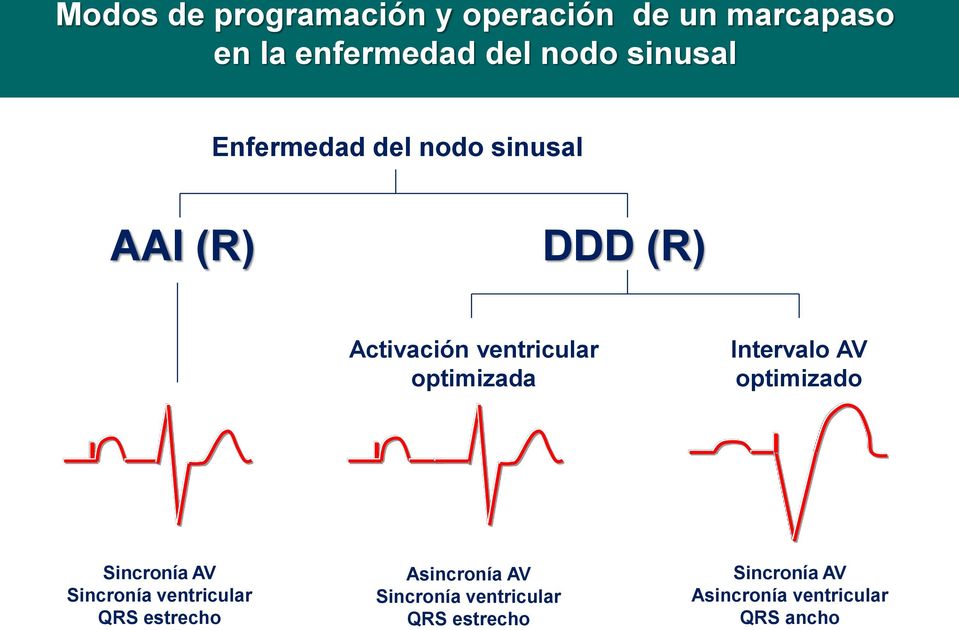 optimizada Intervalo AV optimizado Sincronía AV Sincronía ventricular QRS