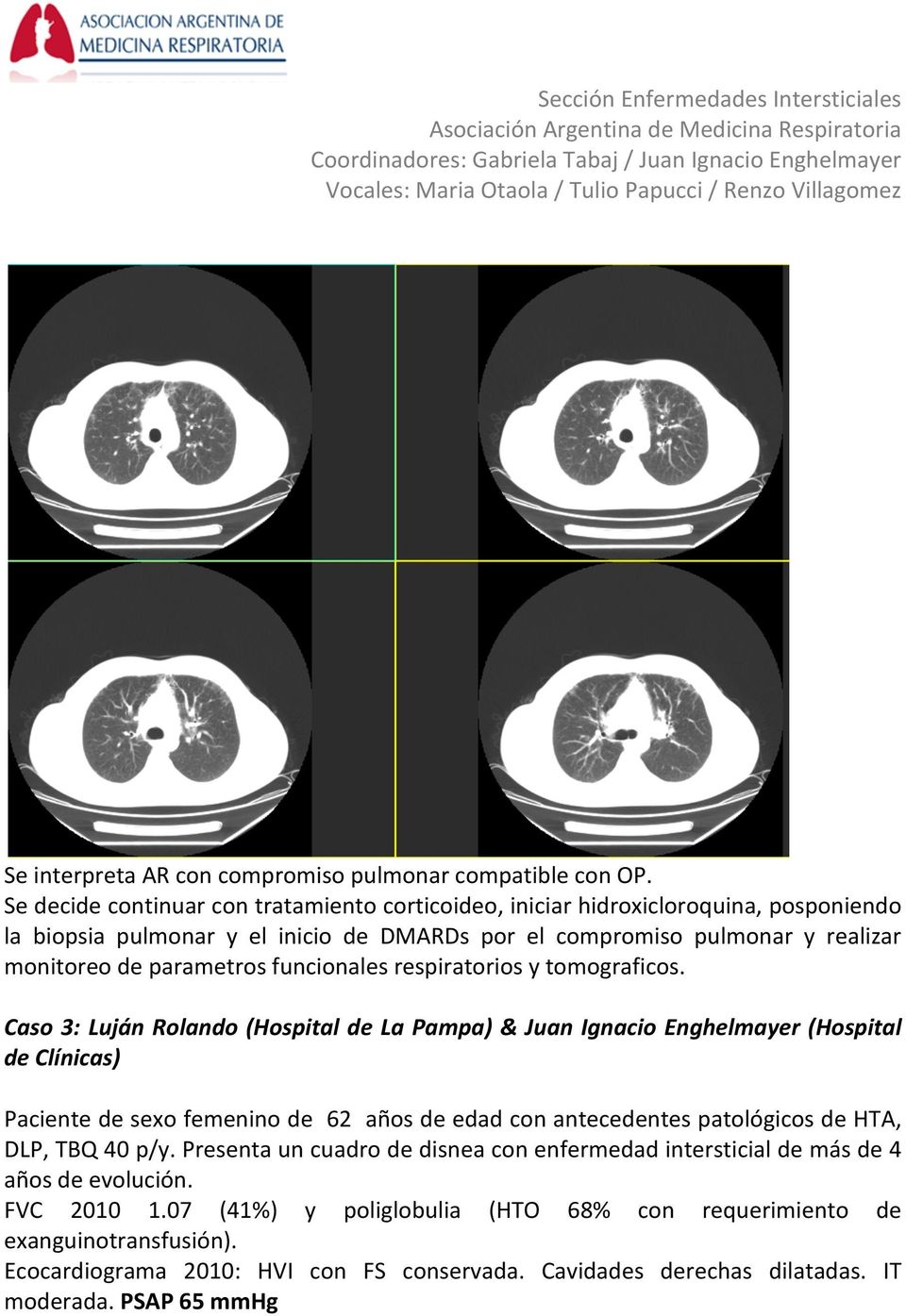 parametros funcionales respiratorios y tomograficos.