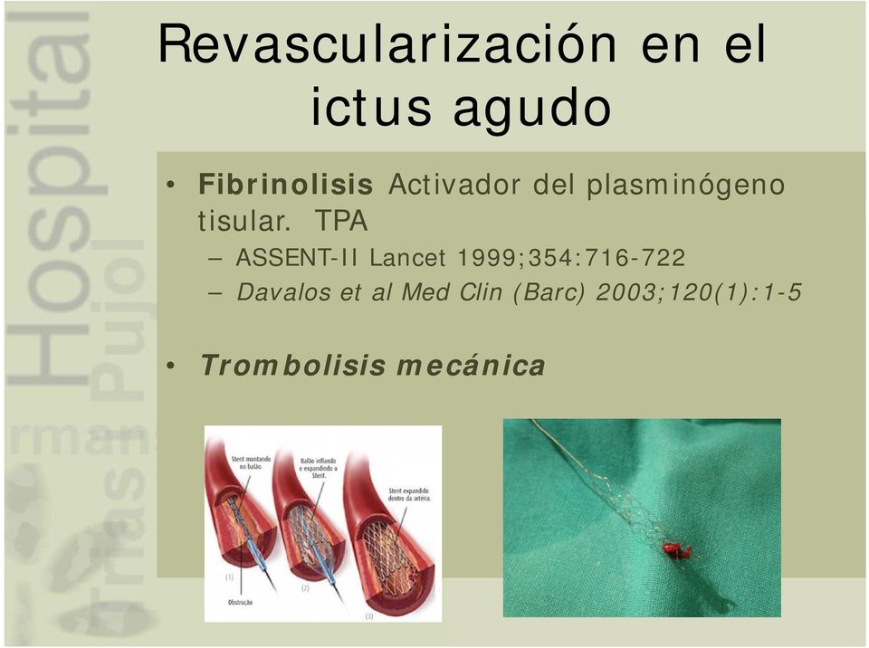 TPA ASSENT-II Lancet 1999;354:716-722 Davalos