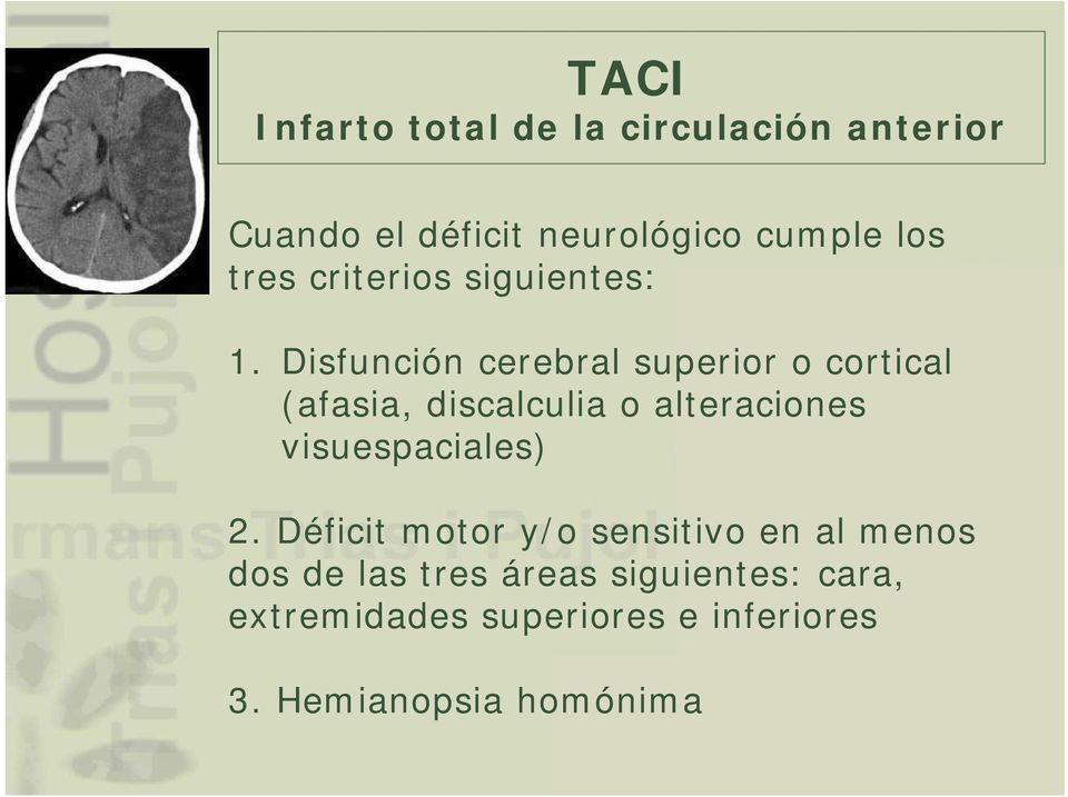 Disfunción cerebral superior o cortical (afasia, discalculia o alteraciones